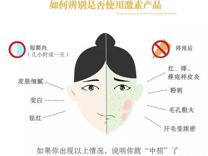 護膚品含激素嗎?對人體有什么危害?含有激素的護膚品名單 護膚品含激素嗎?對人體有什么危害?含有激素的護膚品名單
